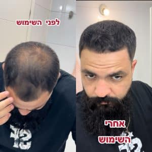 אבקת זקיקי שיער צבע שחור