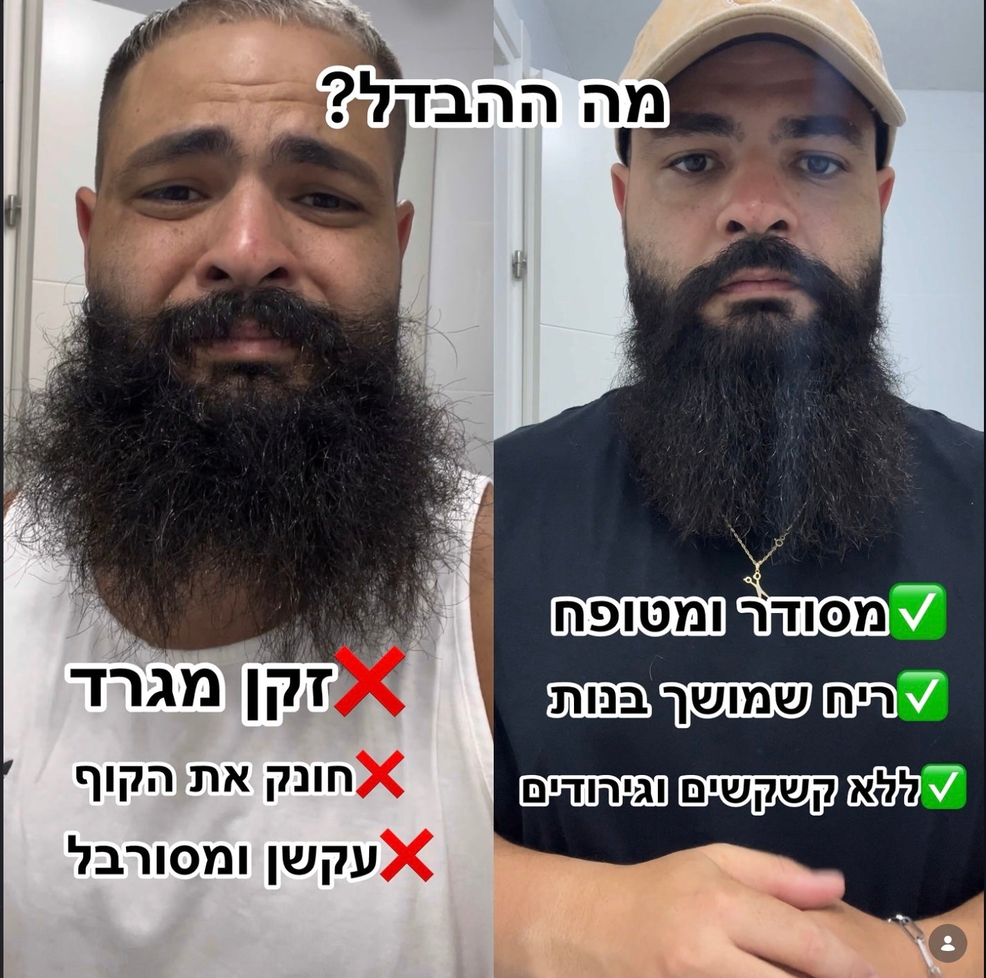 לפני ואחרי: זקן מסודר ומטופח יותר עם שופוני